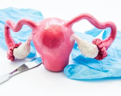 HYSTERECTOMY (UTERUS REMOVAL)